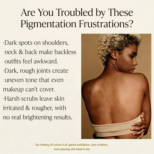 IVYLILA Yellow Peeling Oil: Gentle Body Hyperpigmentation Treatment | Fade Dark Spots