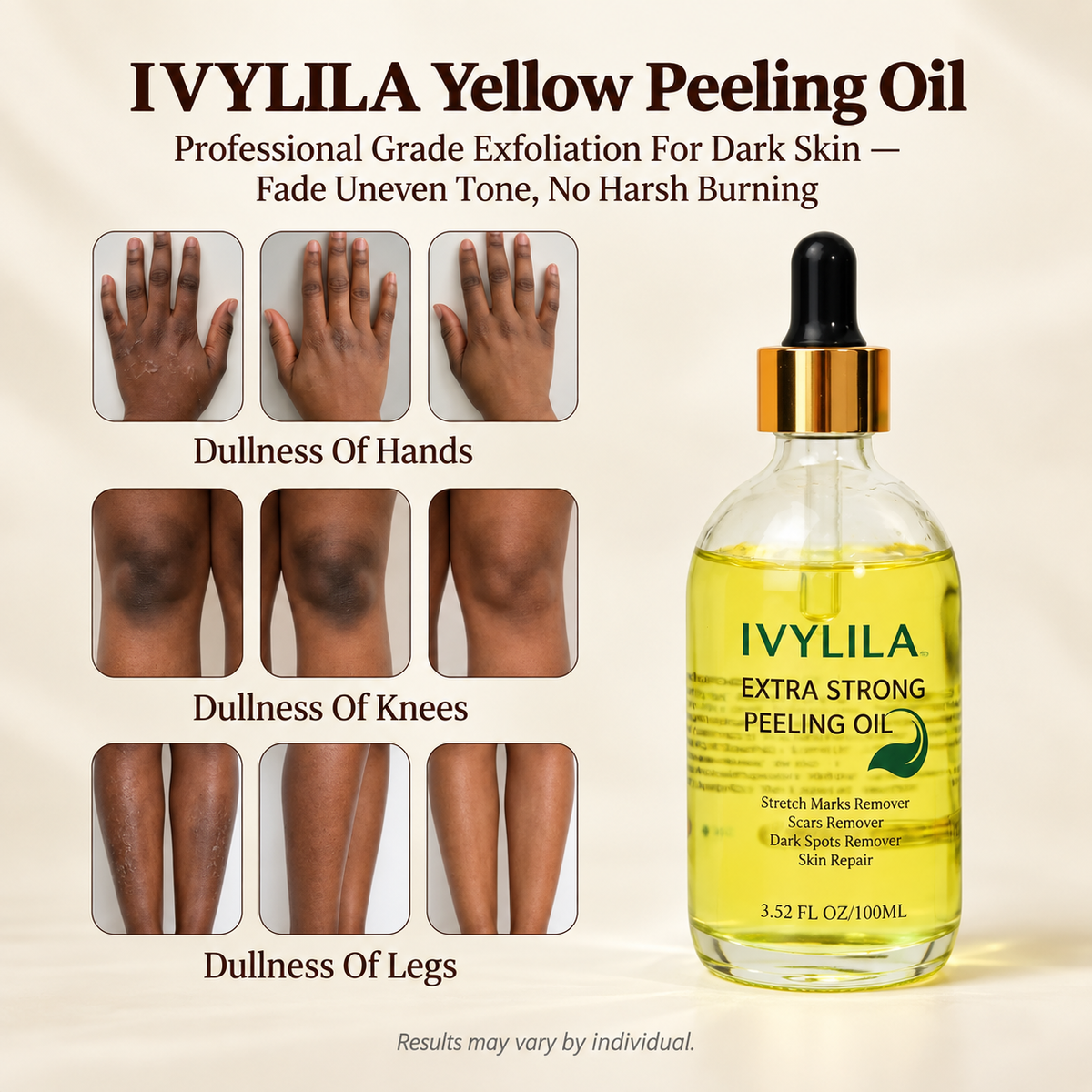 IVYLILA Yellow Peeling Oil: Gentle Body Hyperpigmentation Treatment | Fade Dark Spots