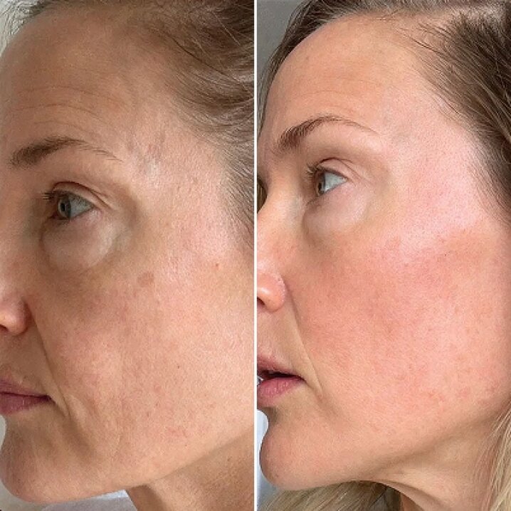 10 Reasons Women over 50 Are Choosing Rejuvenate Serum to Stay Ahead of Aging