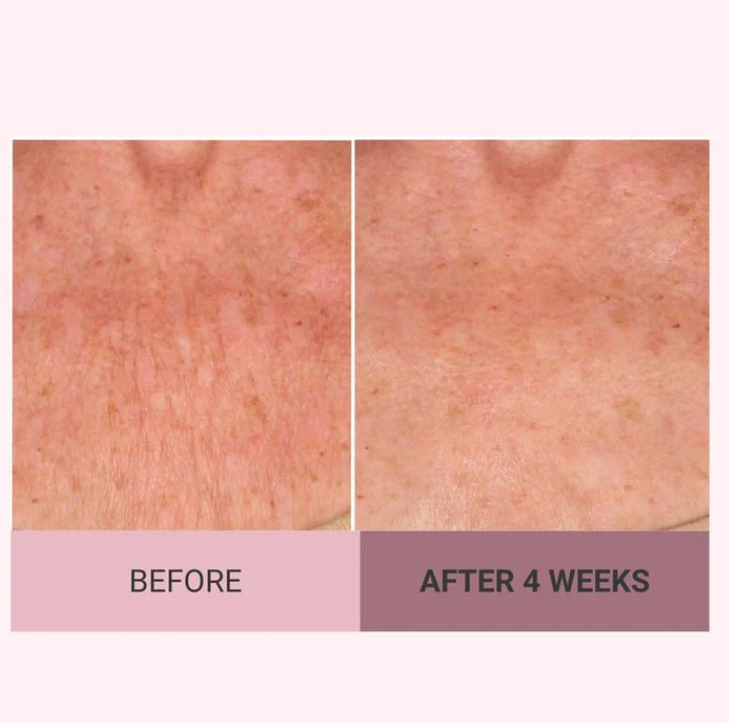 Lifting & Firming Body Cream