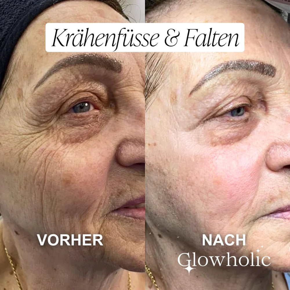 The “Face Lift In A Bottle” Everyone’s Talking About