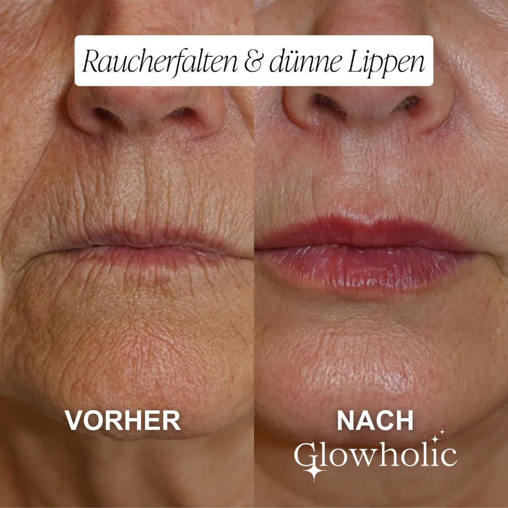 The “Face Lift In A Bottle” Everyone’s Talking About