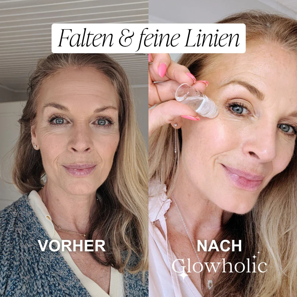 The “Face Lift In A Bottle” Everyone’s Talking About