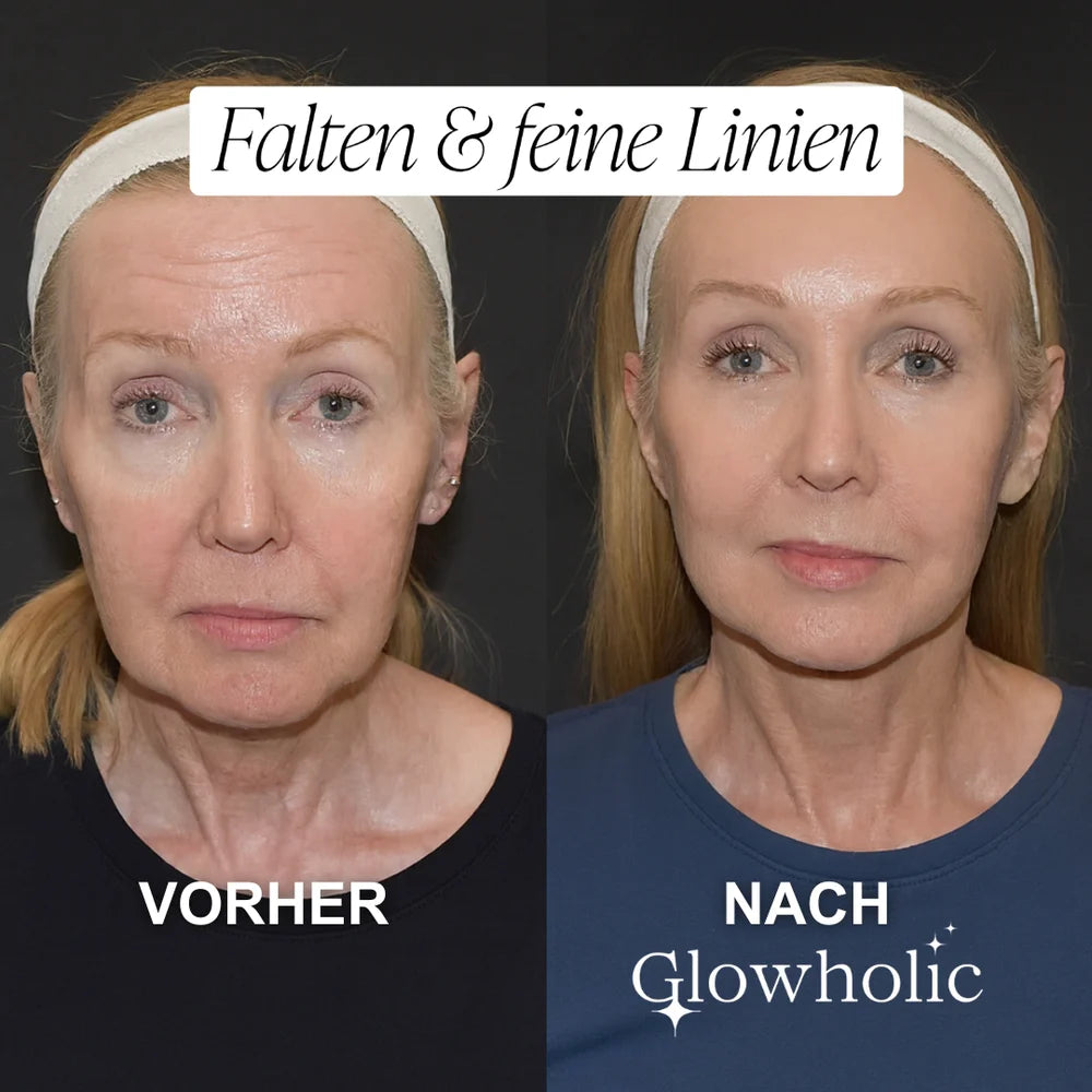 The “Face Lift In A Bottle” Everyone’s Talking About