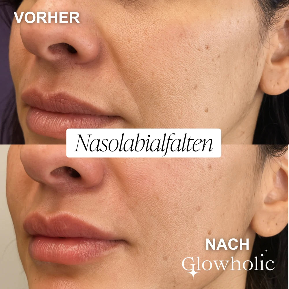 The “Face Lift In A Bottle” Everyone’s Talking About